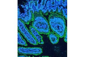 IF analysis of Villi using anti-Villi antibody (ABIN3042343) Villi was detected in paraffin-embedded section of mouse intestine tissues. (Villin 1 antibody  (C-Term))