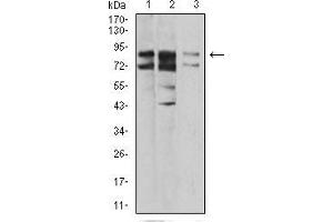 Western blot analysis using IL1RAPL1 mouse mAb against A431 (1), SK-Hep-1 (2), and HL-7702 (3) cell lysate.