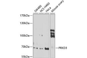 Western blot analysis of extracts of various cell lines, using PRKD3 antibody (ABIN6128465, ABIN6146216, ABIN6146217 and ABIN6222885) at 1:1000 dilution. (PRKD3 antibody  (AA 1-100))