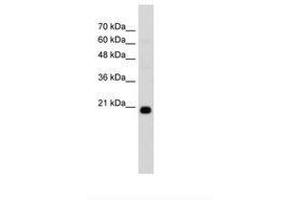 Image no. 2 for anti-F-Box Protein 25 (FBXO25) (C-Term) antibody (ABIN203458) (FBXO25 antibody  (C-Term))