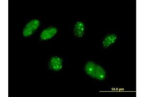 Immunofluorescence of purified MaxPab antibody to KATNAL2 on HeLa cell. (KATNAL2 antibody  (AA 1-466))