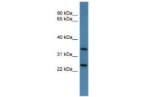 WB Suggested Anti-Clns1a Antibody Titration: 0. (CLNS1A antibody  (C-Term))