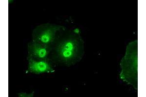 Anti-BIRC7 mouse monoclonal antibody (ABIN2452813) immunofluorescent staining of COS7 cells transiently transfected by pCMV6-ENTRY BIRC7 (RC204906). (BIRC7 antibody)