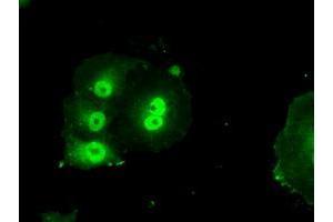 Anti-BIRC7 mouse monoclonal antibody (ABIN2452813) immunofluorescent staining of COS7 cells transiently transfected by pCMV6-ENTRY BIRC7 (RC204906).