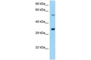 Image no. 1 for anti-Ubiquitin Specific Peptidase 27, X-Linked (USP27X) (AA 91-140) antibody (ABIN6748295) (USP27X antibody  (AA 91-140))