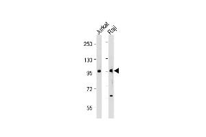 All lanes : Anti-P4K1 Antibody at 1:2000 dilution Lane 1: Jurkat whole cell lysate Lane 2: Raji whole cell lysate Lysates/proteins at 20 μg per lane. (MAP4K1 antibody  (Tyr381))