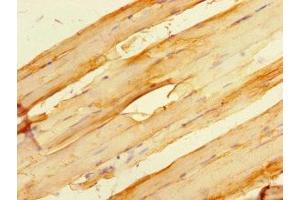 Immunohistochemistry of paraffin-embedded human skeletal muscle tissue using ABIN7154917 at dilution of 1:100