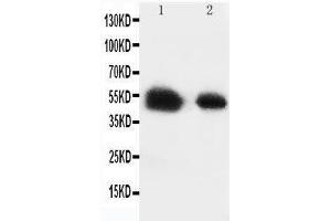 SLC2A8 Antikörper  (C-Term)