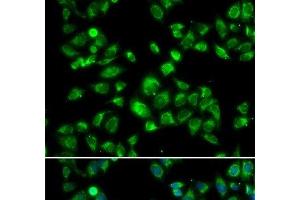 MBTPS1 antibody