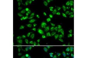 Immunofluorescence analysis of U2OS cells using MBTPS1 Polyclonal Antibody (MBTPS1 antibody)