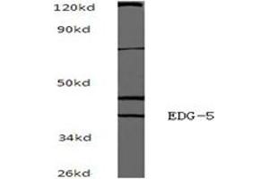 Image no. 1 for anti-Sphingosine-1-Phosphate Receptor 2 (S1PR2) antibody (ABIN317633) (S1PR2 antibody)