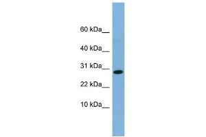 RPE antibody used at 1 ug/ml to detect target protein. (RPE antibody  (Middle Region))