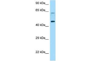 WB Suggested Anti-CRHR1 Antibody Titration: 1. (CRHR1 antibody  (C-Term))