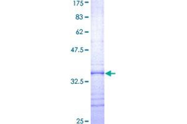 TYROBP Protein (AA 21-113) (GST tag)