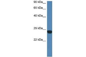 WB Suggested Anti-Ccdc90b Antibody   Titration: 1. (CCDC90B antibody  (N-Term))