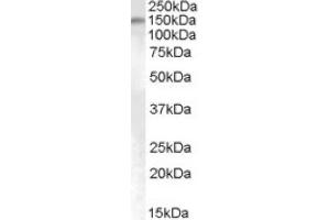 Image no. 1 for anti-SUMO1/sentrin Specific Protease 6 (SENP6) (Internal Region) antibody (ABIN375243) (SENP6 antibody  (Internal Region))
