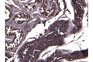 (ABIN7505817) (8 μg/mL) staining of paraffin embedded Human Testis. (ACE2 antibody  (C-Term))