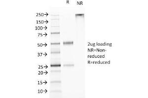 SDS-PAGE Analysis Purified TNFS15 / VEGI Monoclonal Antibody (VEGI /1283). (TNFSF15 antibody)