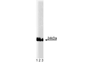 Western blot analysis of caveolin-1 (pY14) on lysates from A431 cells (Human epithelial carcinoma, ATCC CRL-1555) treated with 100 ng/mL EGF.