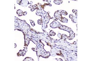 IHC analysis of AHR using anti-AHR antibody (ABIN6719265). (Aryl Hydrocarbon Receptor antibody)