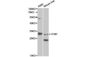 Western blot analysis of extracts of various cell lines, using TPMT antibody. (TPMT antibody)