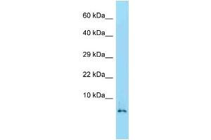 WB Suggested Anti-Hmgn2 Antibody   Titration: 1. (HMGN2 antibody  (Middle Region))