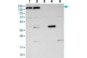Western blot analysis of Lane 1: RT-4, Lane 2: U-251 MG, Lane 3: Human Plasma, Lane 4: Liver, Lane 5: Tonsil with POLR2B polyclonal antibody  at 1:250-1:500 dilution. (POLR2B antibody)