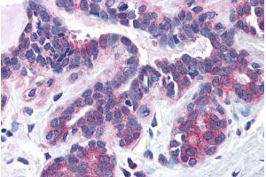 Immunohistochemistry (IHC) image for anti-Sorting Nexin 16 (SNX16) (N-Term) antibody (ABIN184967)