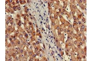 Immunohistochemistry of paraffin-embedded human liver tissue using ABIN7164093 at dilution of 1:100 (PRDM2 antibody  (AA 733-961))