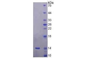 SDS-PAGE analysis of Rat Corin Protein. (Corin Protein)