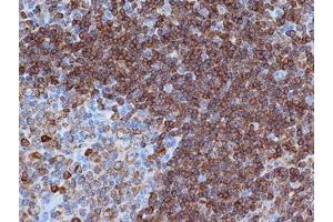 Immunohistochemistry (IHC) image for anti-B-cell antigen receptor complex-associated protein alpha chain (CD79A) (AA 202-216) antibody (ABIN181098) (CD79a antibody  (AA 202-216))