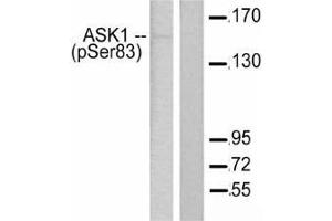Western blot (WB) analysis of p-ASK1 antibody in paraffin-embedded human breast carcinoma tissue.