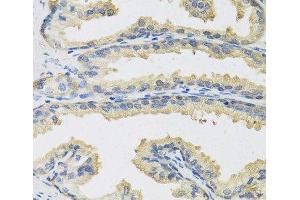 Immunohistochemistry of paraffin-embedded Human prostate using CST3 Polyclonal Antibody at dilution of 1:100 (40x lens). (CST3 antibody)