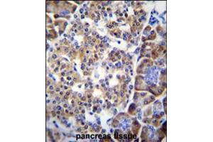 SMYD4 Antibody immunohistochemistry analysis in formalin fixed and paraffin embedded human pancreas tissue followed by peroxidase conjugation of the secondary antibody and DAB staining. (SMYD4 antibody  (C-Term))