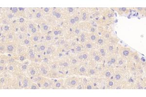 Detection of NOS1AP in Mouse Liver Tissue using Polyclonal Antibody to Nitric Oxide Synthase 1 Adaptor Protein (NOS1AP) (NOS1AP antibody  (AA 19-251))