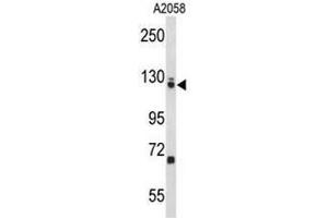 Western Blotting (WB) image for anti-Elongation Factor Tu GTP Binding Domain Containing 2 (EFTUD2) (AA 263-293), (Middle Region) antibody (ABIN955417)