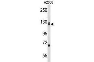 Western blot analysis of EFTUD2 Antibody (Center) in A2058 cell line lysates (35µg/lane). (EFTUD2 antibody  (Middle Region))