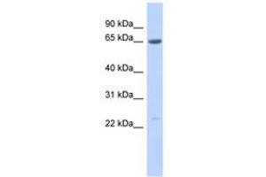 Image no. 1 for anti-Synovial Sarcoma, X Breakpoint 7 (SSX7) (AA 107-156) antibody (ABIN6743585) (SSX7 antibody  (AA 107-156))