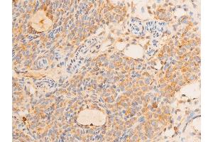 ABIN6267232 at 1/100 staining rat ovarian tissue sections by IHC-P. (Tumor Protein p73 antibody  (pTyr99))