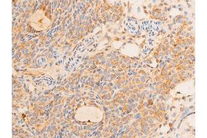 ABIN6267232 at 1/100 staining rat ovarian tissue sections by IHC-P.