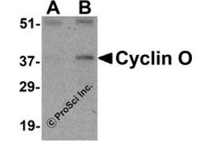 Western Blotting (WB) image for anti-Cyclin O (CCNO) (N-Term) antibody (ABIN1031340) (Cyclin O antibody  (N-Term))