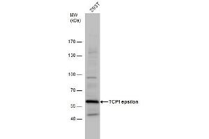 WB Image TCP1 epsilon antibody detects TCP1 protein by western blot analysis. (CCT5 antibody)