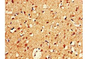 IHC image of ABIN7148735 diluted at 1:600 and staining in paraffin-embedded human brain tissue performed on a Leica BondTM system. (CELF2 antibody  (AA 291-381))
