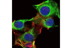 Immunofluorescence analysis of U251 cells using FYN mouse mAb (green).