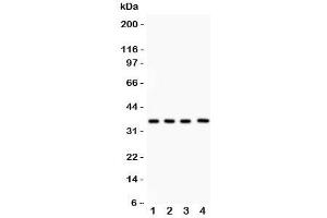 Western blot testing of PBK antibody and Lane 1:  rat testis;  2: mouse testis;  3: human placenta;  4: (h) Jurkat lysate.
