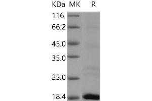 Western Blotting (WB) image for Riboflavin Kinase (RFK) protein (His tag) (ABIN7197718) (Riboflavin Kinase Protein (RFK) (His tag))