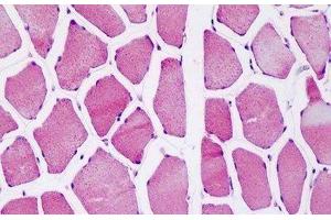 Human Skeletal Muscle: Formalin-Fixed, Paraffin-Embedded (FFPE) (ATP5O antibody  (AA 38-64))