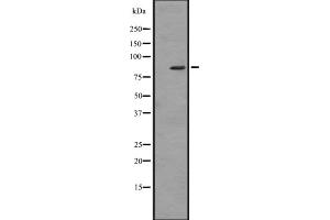 Western blot analysis of ZBTB16 expression in HL60 (Human promyelocytic leukemia cell line) Whole Cell Lysate,The lane on the left is treated with the antigen-specific peptide. (ZBTB16 antibody  (Internal Region))