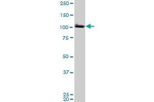 MCM3 monoclonal antibody (M01A), clone 4F7. (MCM3 antibody  (AA 699-808))