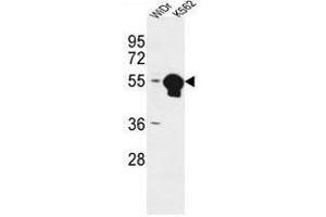 ATP6V1B1 Antibody (Center) western blot analysis in WiDr,K562 cell line lysates (35µg/lane). (ATP6V1B1 antibody  (Middle Region))